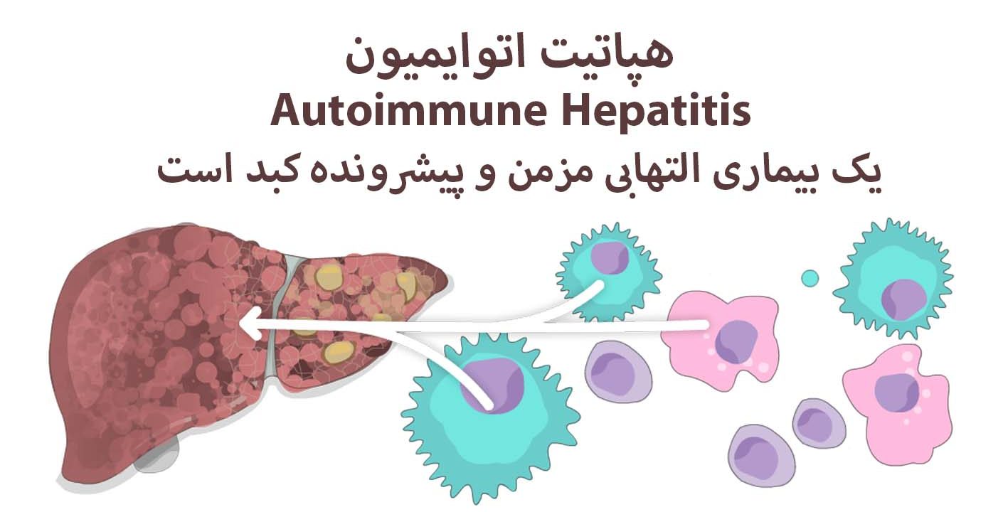 هپاتیت اتوایمیون تازه های تندرستی دکتر سعید شاه بیگی