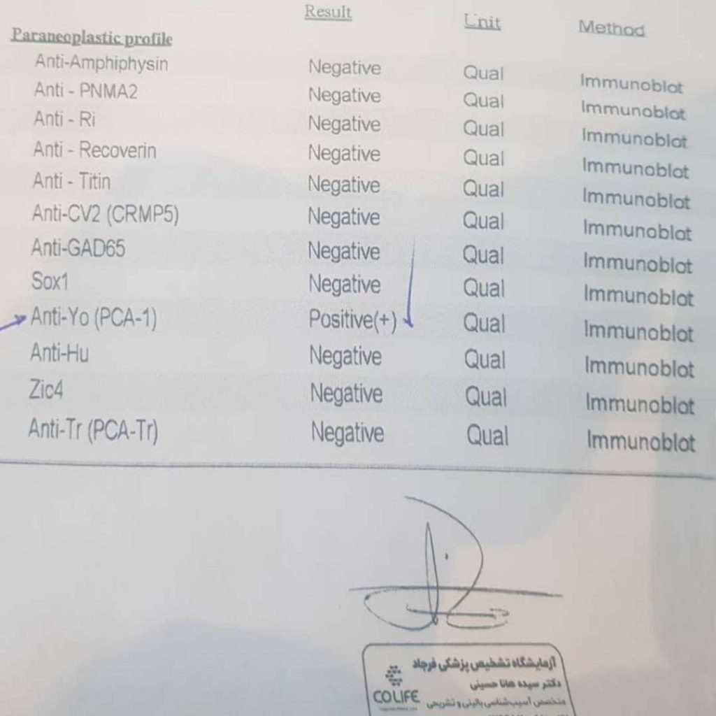 مطالعه موردی بیمار : مرد 89 ساله دچار اختلال حواس و حافظه همراه با اختلالات شخصیتی - دکتر سعید شاه بیگی