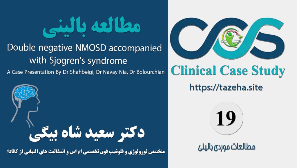 Case Study 19 - Double negative NMOSD accompanied with Sjogren's syndrome a case presentation By Dr Shahbeigi, Dr Navay Nia, Dr Bolourchian