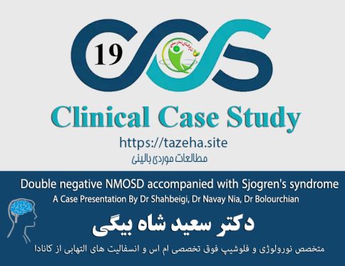 Case Study 19 - Double negative NMOSD accompanied with Sjogren's syndrome a case presentation By Dr Shahbeigi, Dr Navay Nia, Dr Bolourchian