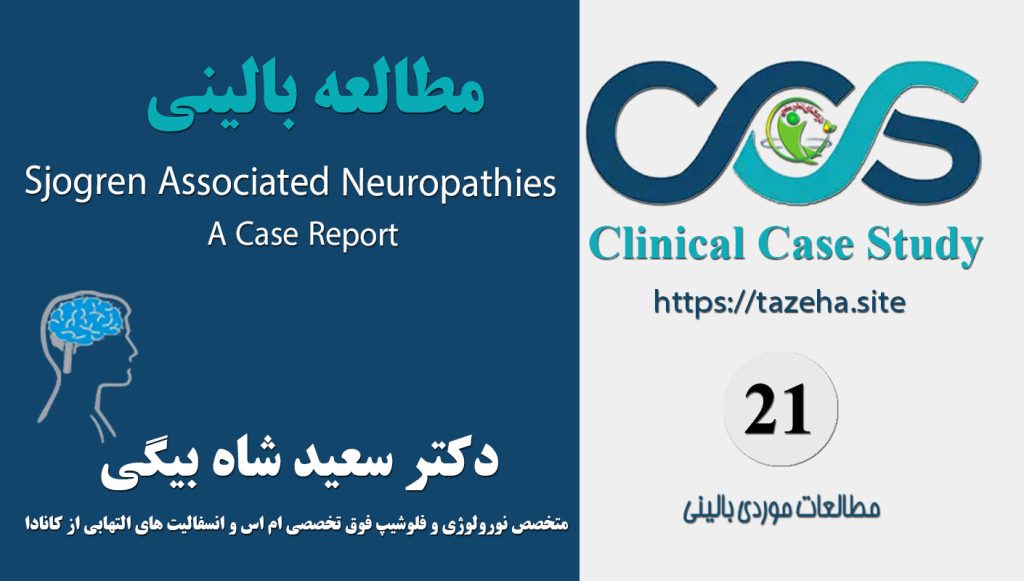 Sjogren associated neuropathies, A Case report