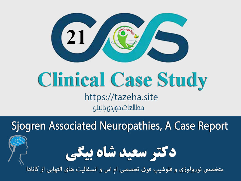 Sjogren associated neuropathies, A Case report