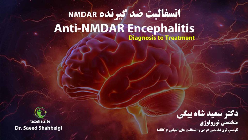 2. انسفالیت ضد گیرنده NMDA - دکتر سعید شاه بیگی نورولوژیست فلوشیپ فوق تخصصی ام اس و انسفالیت های التهابی از کانادا