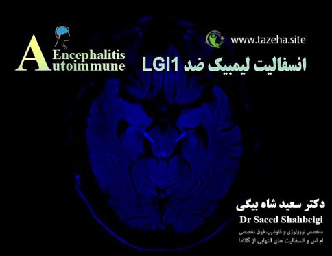 انسفالیت لیمبیک ضد LGI1 دکتر سعید شاه بیگی متخصص مغز و اعصاب و فلوشیپ فوق تخصصی ام اس و انسفالیت های التهابی مغز و نخاع از کانادا
