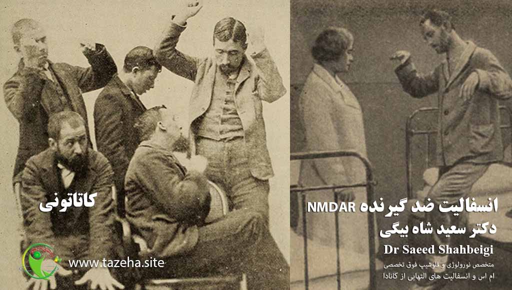 4. انسفالیت ضد گیرنده NMDA - دکتر سعید شاه بیگی نورولوژیست فلوشیپ فوق تخصصی ام اس و انسفالیت های التهابی از کانادا