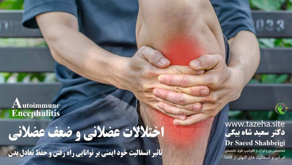 تاثیر انسفالیت خود ایمنی بر توانایی راه رفتن و حفظ تعادل بدن دکتر سعید شاه بیگی متخصص مغز و اعصاب و فلوشیپ فوق تخصصی ام اس و انسفالیت های التهابی مغز و نخاع از کانادا