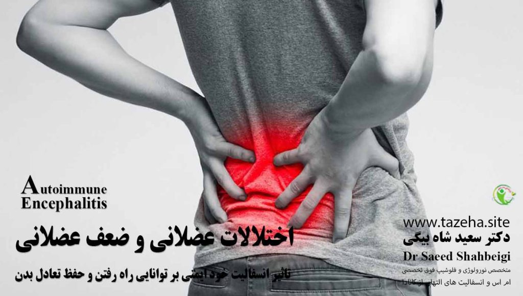 تاثیر انسفالیت خود ایمنی بر توانایی راه رفتن و حفظ تعادل بدن دکتر سعید شاه بیگی متخصص مغز و اعصاب و فلوشیپ فوق تخصصی ام اس و انسفالیت های التهابی مغز و نخاع از کانادا