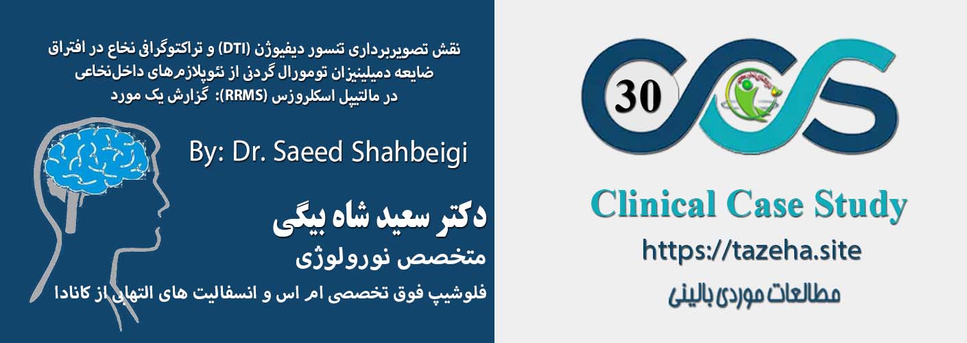 مستر اسلایدر: ضایعه تومورال نخاعی در مولتیپل اسکلروزیس عودکننده دکتر سعید شاه بیگی