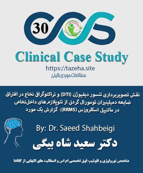 موبایل اسلایدر: ضایعه تومورال نخاعی در مولتیپل اسکلروزیس عودکننده دکتر سعید شاه بیگی