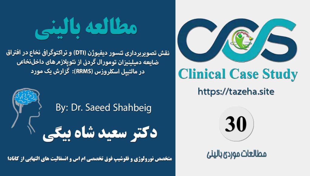 ضایعه تومورال نخاعی در مولتیپل اسکلروزیس عودکننده دکتر سعید شاه بیگی