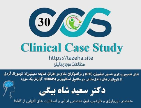 شاخص : ضایعه تومورال نخاعی در مولتیپل اسکلروزیس عودکننده دکتر سعید شاه بیگی